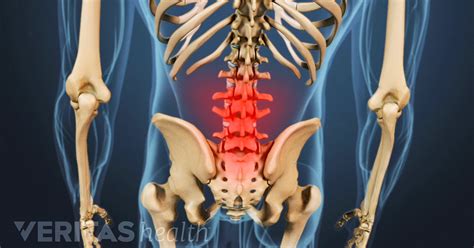 zona spine and pain